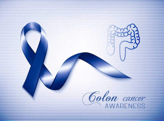 Colon cancer awareness ribbon. Vector