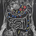 Do You Need a Gut Parasite Cleanse?