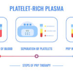 Can Our Own Platelets Cure Both Balding and Acne Scars?
