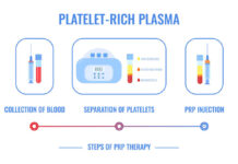 Can Our Own Platelets Cure Both Balding and Acne Scars?